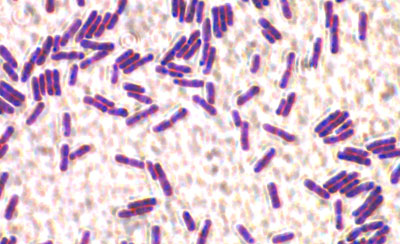 spore-forming bacteria