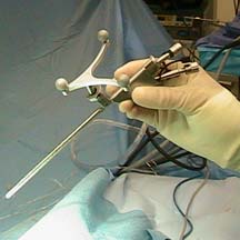 view of an endoscope