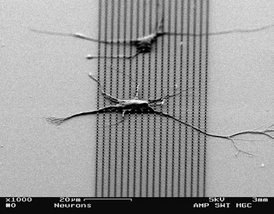 Scanning electron micrograph