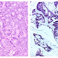 Turn out the light: 'Switch' determines cancer cell fate