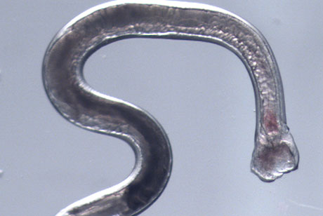 Hookworm genomic study holds promise for treatments