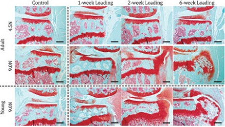 Histologic images show comparison of damage to cartilage