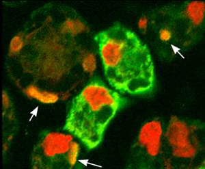 Cells infected with Toxoplasma parasites