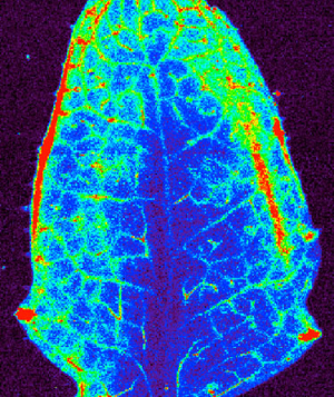 ynchrotron X-ray fluorescence image