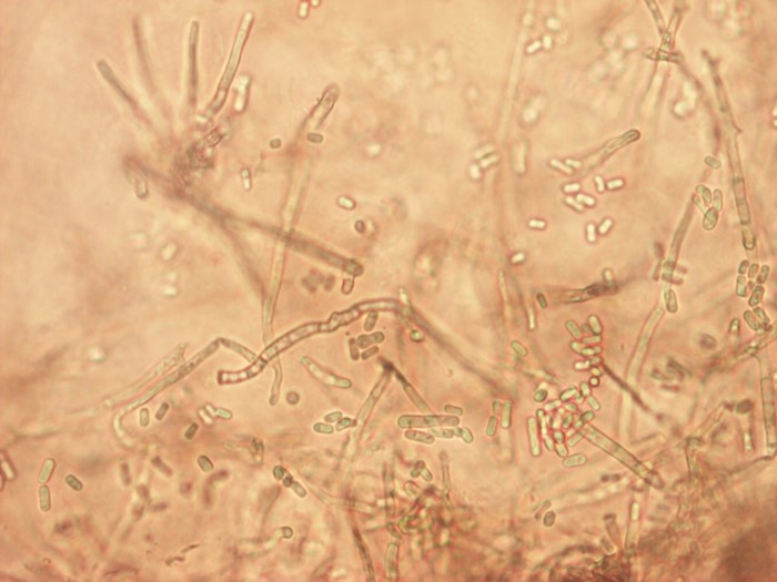 fungal pathogen