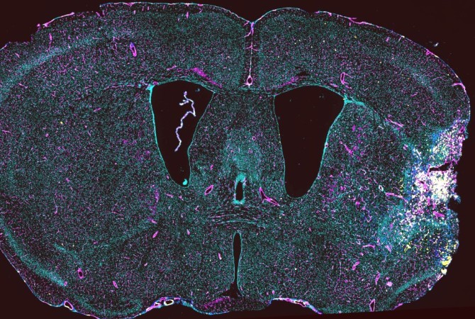 Image of a mouse brain section