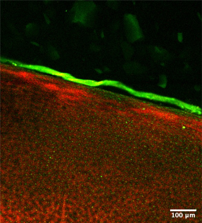 A confocal reflectance micrograph shows a bioengineered lubricant (in green) on the surface of articular cartilage.