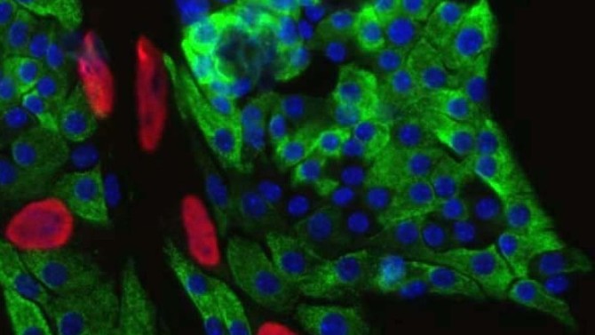 Immunofluorescence showing mouse insulin-producing beta cells from the pancreas. 