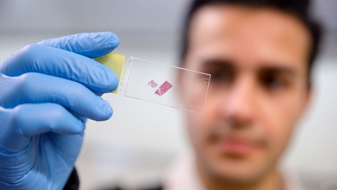 Shariati examines a blood sample on a slide 