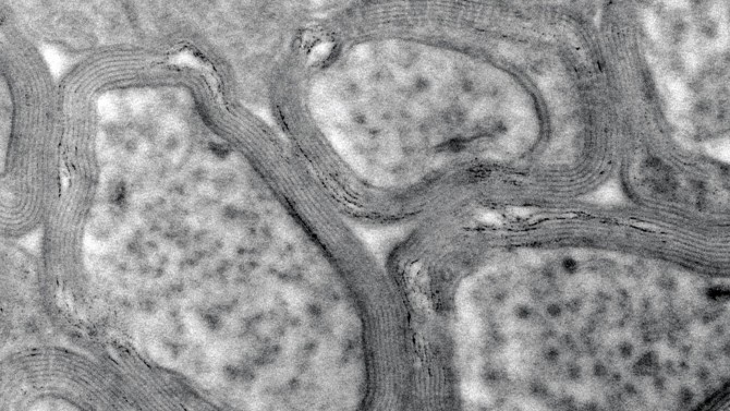 electron microscope shows the myelin sheath in a healthy mouse brain