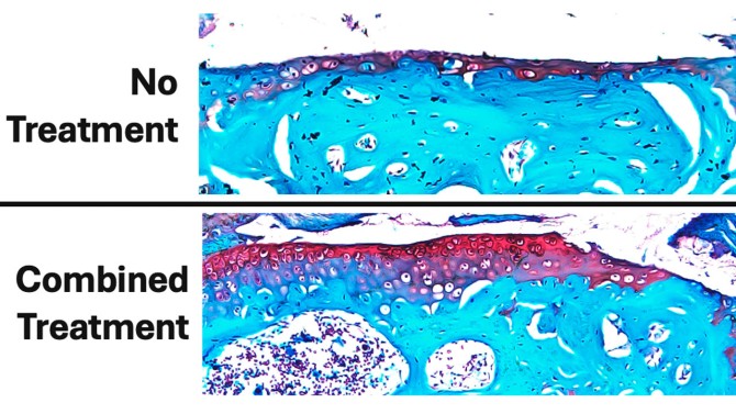 figure shows the extent of cartilage damage after 6 weeks of daily loading and treatment