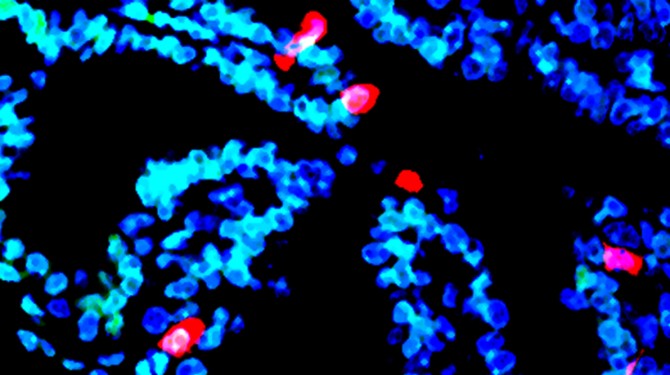 Cancer-prone Krt5+ pre-ciliated cells (red) and ciliated cells (green). A fluorescent dye (blue) reveals DNA in cells.