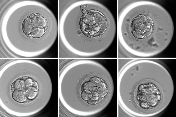 AI-based tool can assist embryologists in determining both the embryo quality score and ploidy status, providing a comprehensive assessment of the embryo.