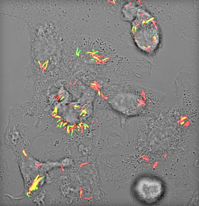 Confocal microscopy image of macrophages infected with tuberculosis bacteria; colors indicate bacteria health status: green bacteria are healthy, while red ones are unhealthy or dying.