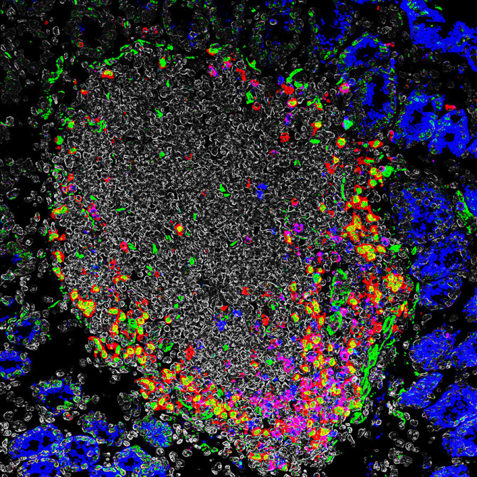 Image visualizing&nbsp;immune cell aggregates in the intestine, demonstrating the presence of RORgt+&nbsp;APCs (red and green) and T cells (blue and red), whose interactions are critical in establishing immune tolerance in the intestine.
