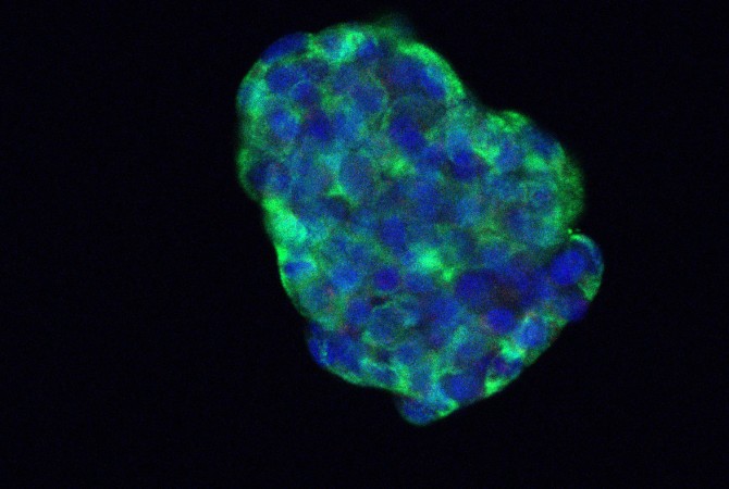 Immunofluorescence showing primary human pancreatic islet