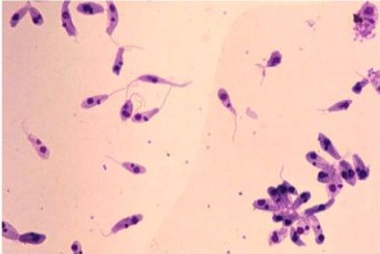 Cutaneous leishmaniasis (CL) under a microscope