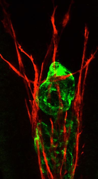 An intestinal lymphatic lacteal (green) requires the support of the surrounding vascular smooth muscle (red).