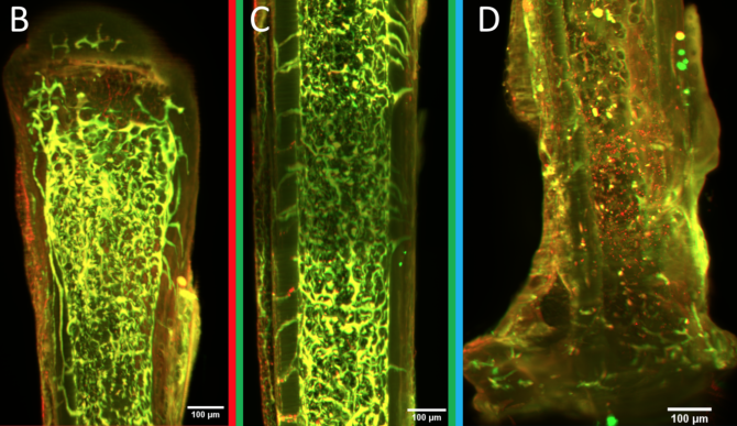 green illuminescent bone microscopy