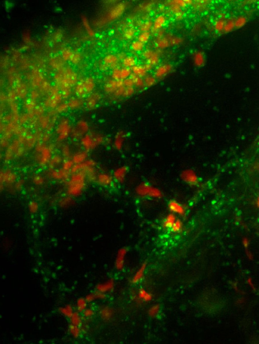 Study of fungi may improve baby food, agriculture, food safety