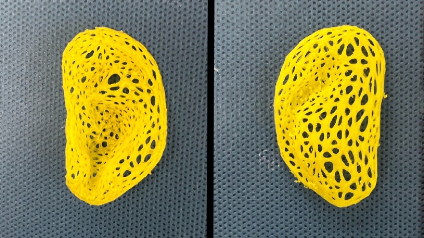 Pictured is the intricate, left-ear plastic scaffold (anterior view at left, posterior view at right) that was created on a 3D printer, based on data from a person’s ear.