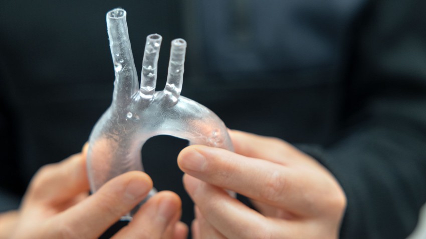 Anova Biomedical's first-of-its-kind biodegradable graft material for cardiovascular patients not only expands and contracts likek blood vessels; it is also absorbed into the body as new cells take its place.