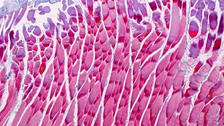 Scientists identify regenerative checkpoint that limits muscle repair