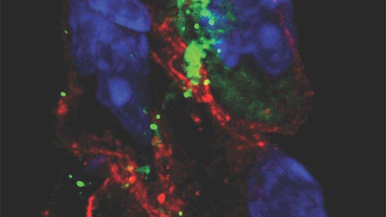 SARS-CoV-2 virus can infect heart's pacemaker cells - Vimarsana News