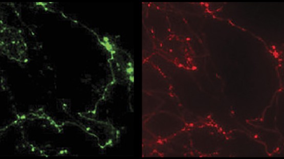 Molecular sensor tracks energy use at the subcellular level - Vimarsana News