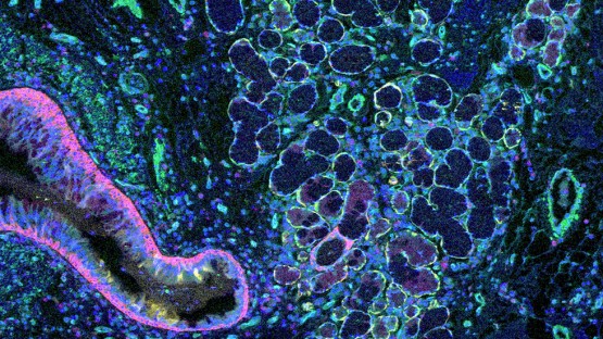 New Computational Method Builds Detailed Maps Of Human Tissues   1101 Elemento 0 