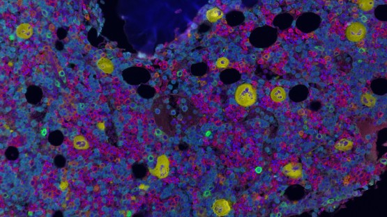 Researchers chart the contents of human bone marrow | Cornell