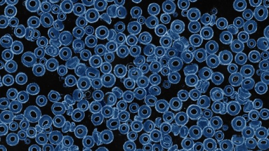Vortex rings may aid cell delivery, cell-free protein production ...