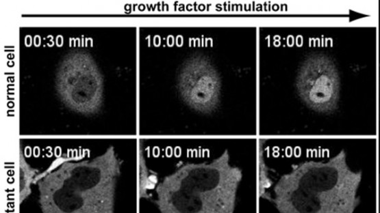 Scientists find clues to some inherited heart diseases | Cornell Chronicle