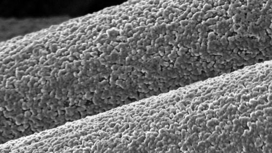 Aluminum-anode batteries offer sustainable alternative - Vimarsana News