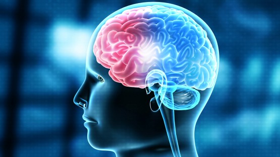 Cerebral hemorrhage linked to stroke, cardiac risks - Vimarsana News
