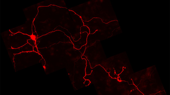 Les neurones vieillissants du mésencéphale font face à une crise énergétique liée à la maladie de Parkinson