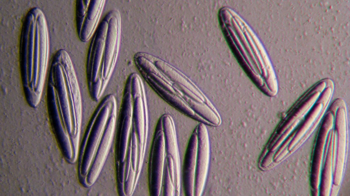 Epulopiscium viviparus bacteria
