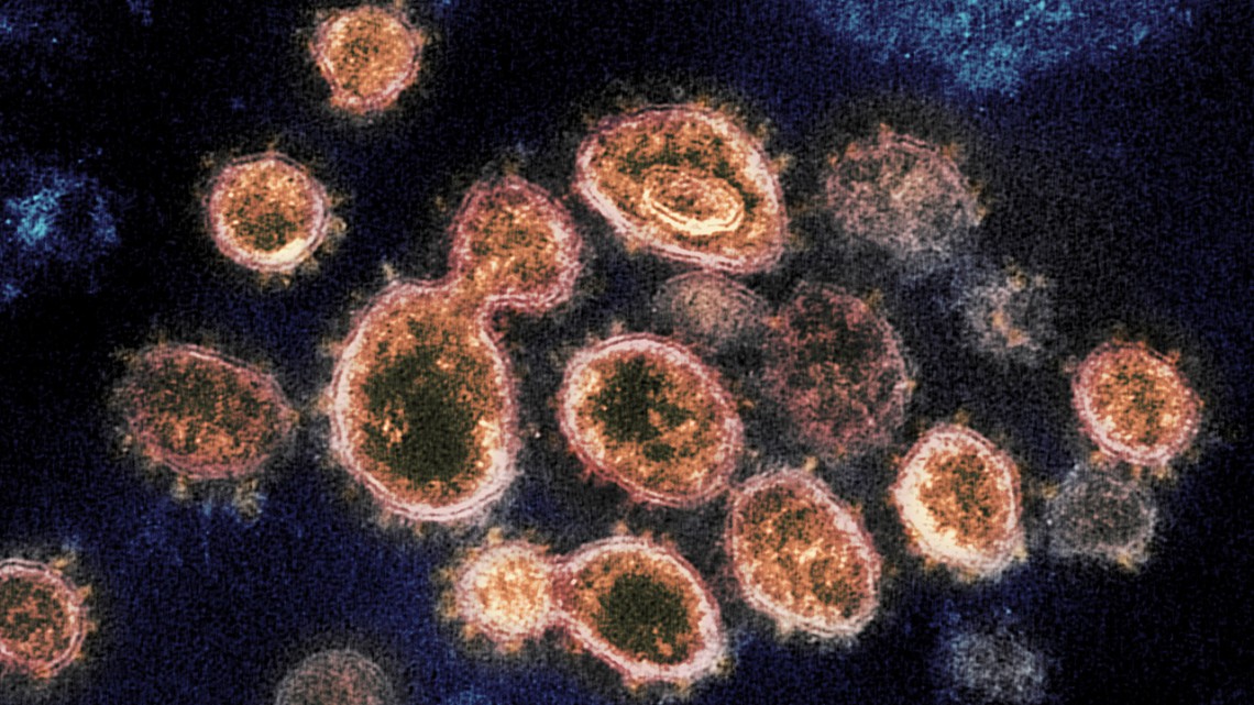 SARS-CoV-2, the virus that causes COVID-19