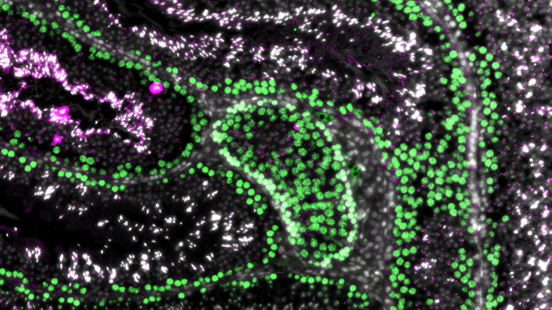 Cross‑section of testis tubules showing stages of spermatogenesis: green meiotic cells, pink developing sperm (dots in top right corner) and pink mature sperm (long cells in middle left), and the pre-meiotic white/gray spermatogonia along the basement membrane (lower left) are stem cells the researchers aim to preserve.