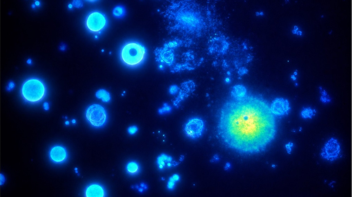 glowing blue blobs against a dark blue background, including one large blog with a yellow and green center