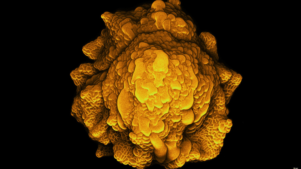 Microscopy image of a mutant flower bud with wrinkled and irregular sepals. Cells are shown in gold.