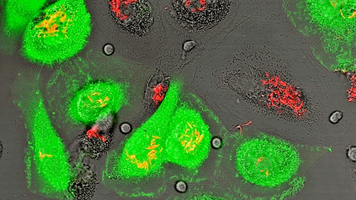 Bright green microscope image of HIV TB
